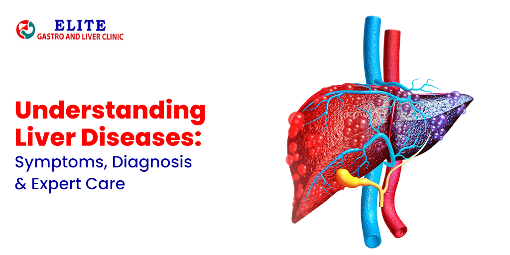 Understanding Liver Diseases: Symptoms, Diagnosis & Expert Care