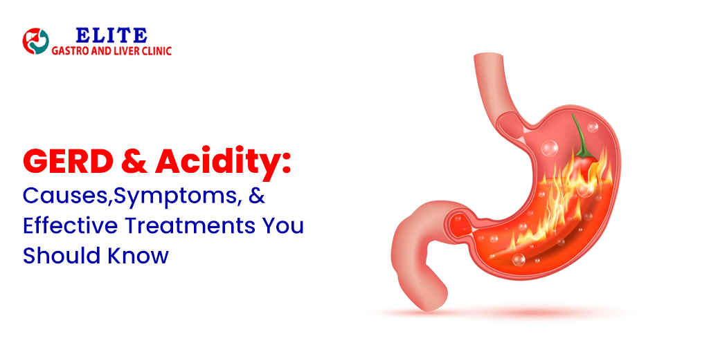 GERD & Acidity: Causes, Symptoms, and Effective Treatments You Should Know